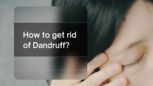get rid of dandruff